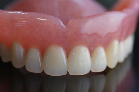 denture repair services everett  Our dentures and implants are customized to match your needs and budget
